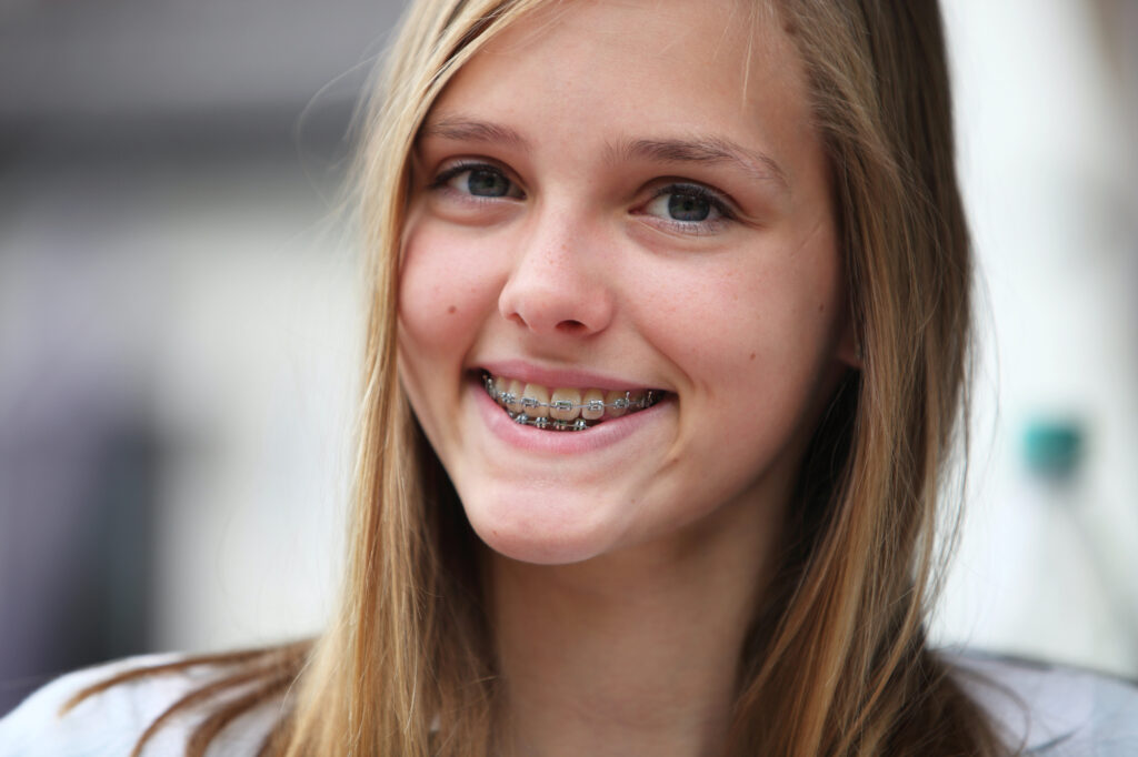 Adolescent Orthodontics